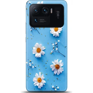 Phone Kılıf Xiaomi Mi 11 Ultra Kılıf Hd Baskılı Kılıf - Followed Institution 0170