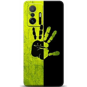 Phone Kılıf Xiaomi Mi 11T Kılıf Hd Baskılı Kılıf - Followed Institution 0648