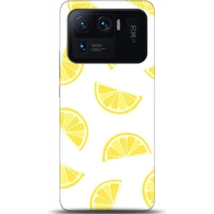 Phone Kılıf Xiaomi Mi 11 Ultra Kılıf Hd Baskılı Kılıf - Followed Institution 0105