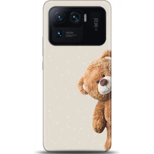Phone Kılıf Xiaomi Mi 11 Ultra Kılıf Hd Baskılı Kılıf - Followed Institution 0005