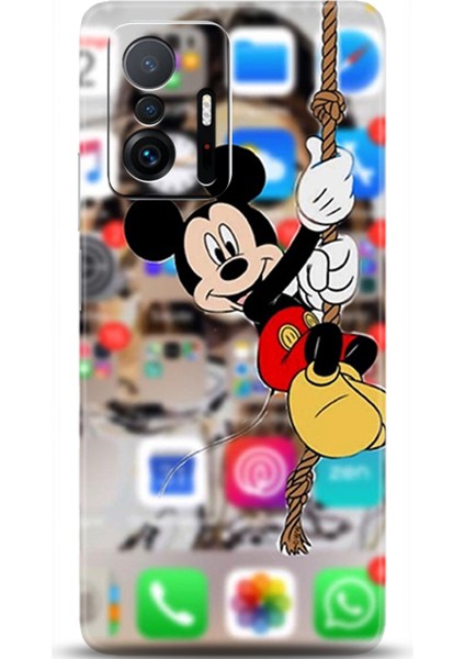 Xiaomi Mi 11T Pro Kılıf Hd Baskılı Kılıf - Followed Institution 0663