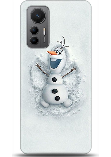 Xiaomi Mi 12 Lite Kılıf Hd Baskılı Kılıf - Followed Institution 0368