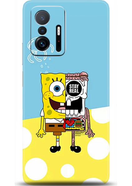 Xiaomi Mi 11T Kılıf Hd Baskılı Kılıf - Followed Institution 0623