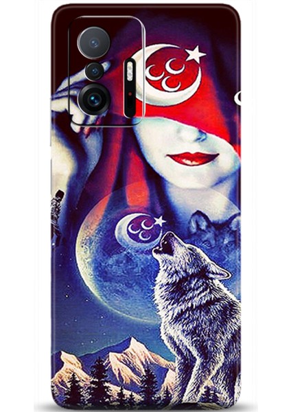 Xiaomi Mi 11T Pro Kılıf Hd Baskılı Kılıf - Followed Institution 0285