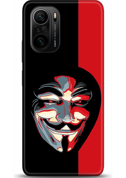 Xiaomi Mi 11i Kılıf Hd Baskılı Kılıf - Followed Institution 0492