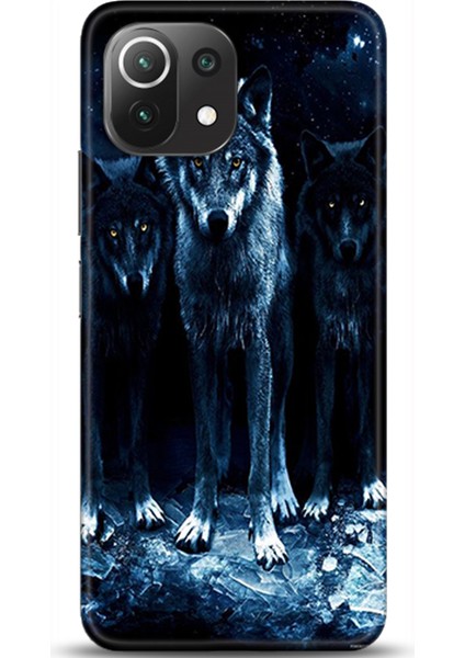 Xiaomi Mi 11 Lite Kılıf Hd Baskılı Kılıf - Followed Institution 0336