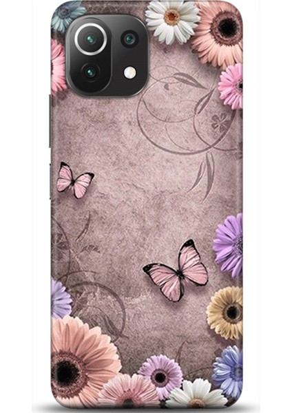 Xiaomi Mi 11 Lite Kılıf Hd Baskılı Kılıf - Followed Institution 0630