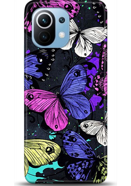 Xiaomi Mi 11 Kılıf Hd Baskılı Kılıf - Followed Institution 0463