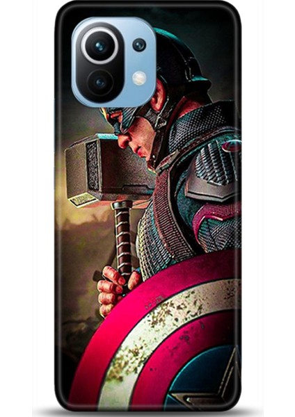 Xiaomi Mi 11 Kılıf Hd Baskılı Kılıf - Followed Institution 0123