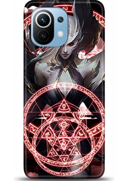 Xiaomi Mi 11 Kılıf Hd Baskılı Kılıf - Followed Institution 0202