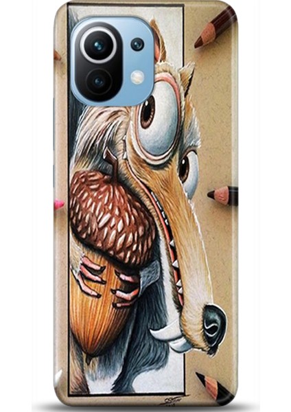 Xiaomi Mi 11 Kılıf Hd Baskılı Kılıf - Followed Institution 0222