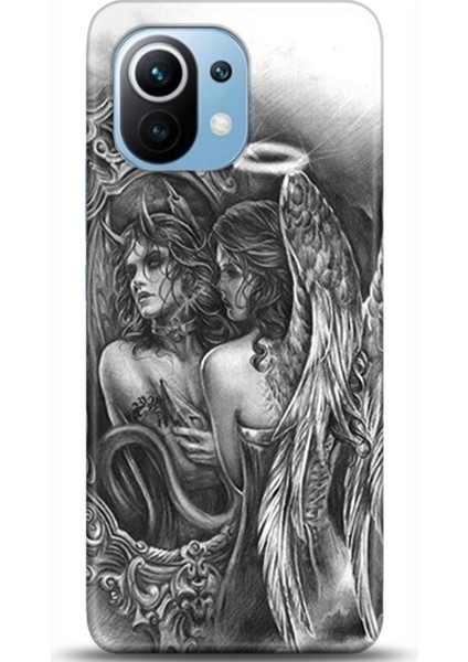 Xiaomi Mi 11 Kılıf Hd Baskılı Kılıf - Followed Institution 0258