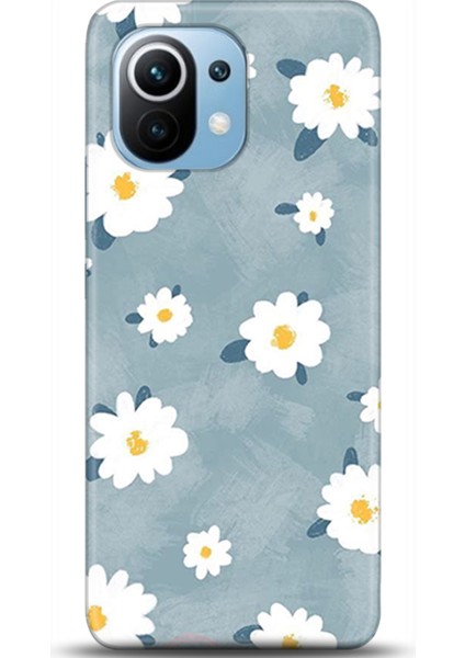 Xiaomi Mi 11 Kılıf Hd Baskılı Kılıf - Followed Institution 0134