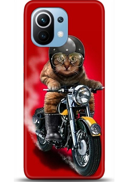 Xiaomi Mi 11 Kılıf Hd Baskılı Kılıf - Followed Institution 0375