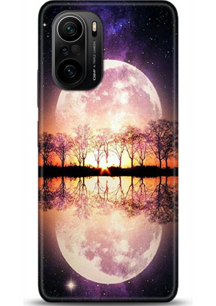 Xiaomi Poco F3 Kılıf Hd Baskılı Kılıf - Followed Institution 0147