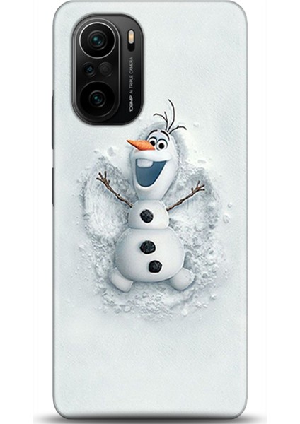 Xiaomi Mi 11i Kılıf Hd Baskılı Kılıf - Followed Institution 0368