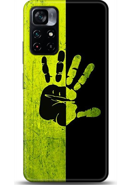 Xiaomi Poco M4 Pro 5g Kılıf Hd Baskılı Kılıf - Followed Institution 0648