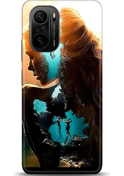 Xiaomi Mi 11i Kılıf Hd Baskılı Kılıf - Followed Institution 0377