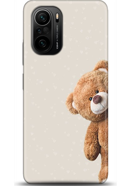 Xiaomi Poco F3 Kılıf Hd Baskılı Kılıf - Followed Institution 0005