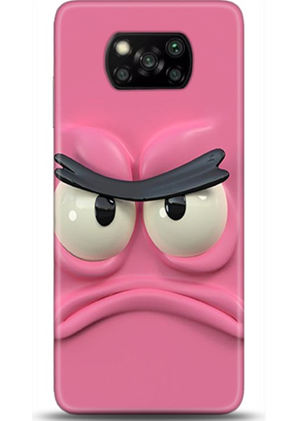 Xiaomi Poco X3 Kılıf Hd Baskılı Kılıf - Followed Institution 0053