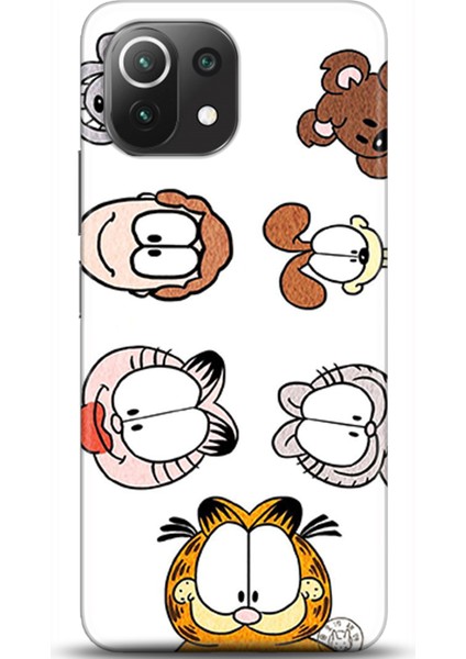 Xiaomi Mi 11 Lite Kılıf Hd Baskılı Kılıf - Followed Institution 0075