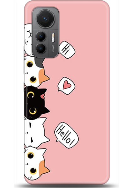 Xiaomi Mi 12 Lite Kılıf Hd Baskılı Kılıf - Followed Institution 0061