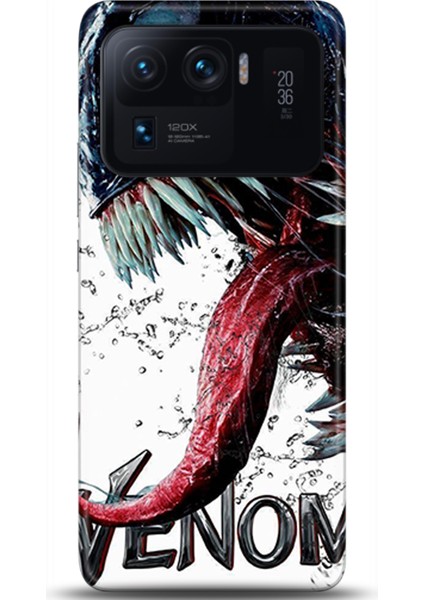 Xiaomi Mi 11 Ultra Kılıf Hd Baskılı Kılıf - Followed Institution 0568