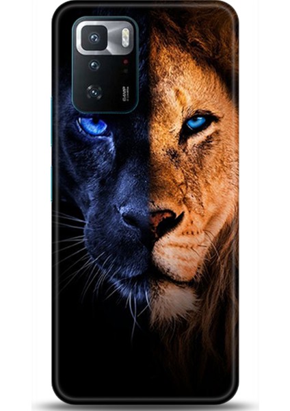 Xiaomi Poco X3 Gt Kılıf Hd Baskılı Kılıf - Followed Institution 0045