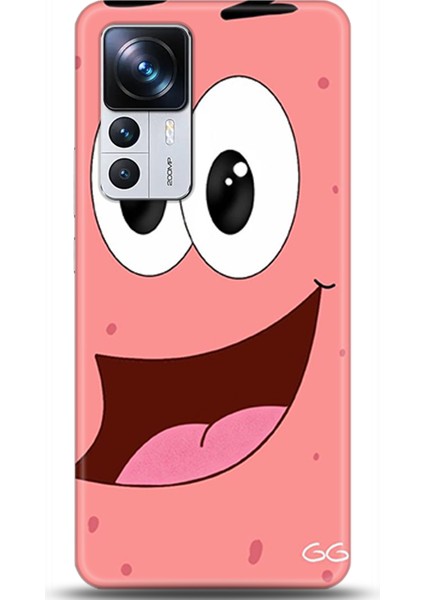 Xiaomi Mi 12T Pro Kılıf Hd Baskılı Kılıf - Followed Institution 0027