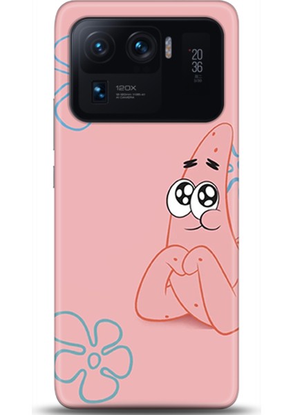 Xiaomi Mi 11 Ultra Kılıf Hd Baskılı Kılıf - Followed Institution 0416