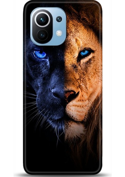 Xiaomi Mi 11 Kılıf Hd Baskılı Kılıf - Followed Institution 0045