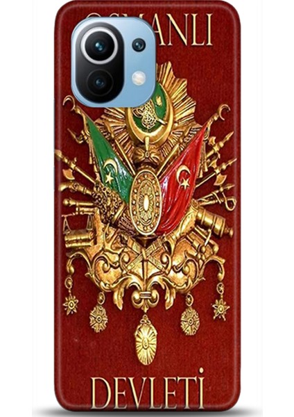Xiaomi Mi 11 Kılıf Hd Baskılı Kılıf - Followed Institution 0317