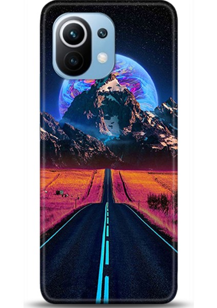 Xiaomi Mi 11 Kılıf Hd Baskılı Kılıf - Followed Institution 0319