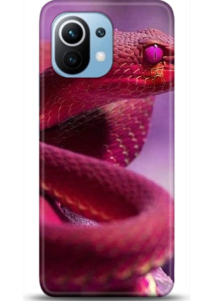 Xiaomi Mi 11 Kılıf Hd Baskılı Kılıf - Followed Institution 0362