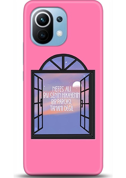 Xiaomi Mi 11 Kılıf Hd Baskılı Kılıf - Followed Institution 0425