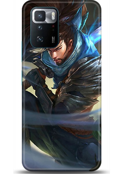 Xiaomi Poco X3 Gt Kılıf Hd Baskılı Kılıf - Followed Institution 0207