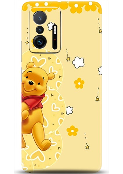 Xiaomi Mi 11T Kılıf Hd Baskılı Kılıf - Followed Institution 0609