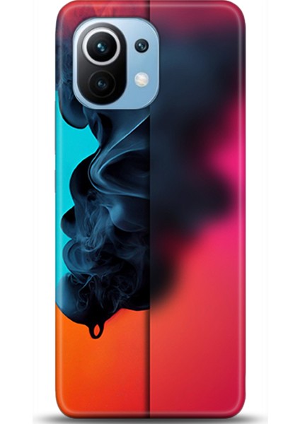 Xiaomi Mi 11 Kılıf Hd Baskılı Kılıf - Followed Institution 0583