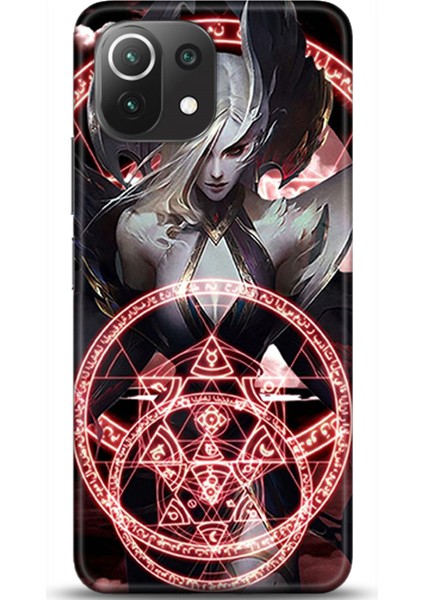 Xiaomi Mi 11 Lite Kılıf Hd Baskılı Kılıf - Followed Institution 0192