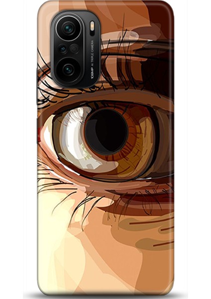 Xiaomi Mi 11i Kılıf Hd Baskılı Kılıf - Followed Institution 0278