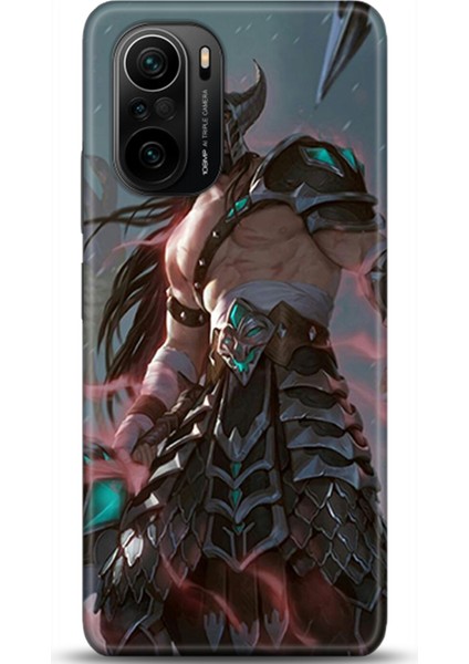 Xiaomi Mi 11i Kılıf Hd Baskılı Kılıf - Followed Institution 0299