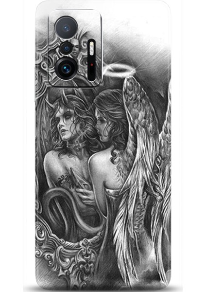 Xiaomi Mi 11T Pro Kılıf Hd Baskılı Kılıf - Followed Institution 0258