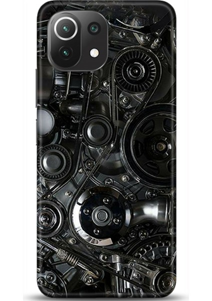 Xiaomi Mi 11 Lite Kılıf Hd Baskılı Kılıf - Followed Institution 0585