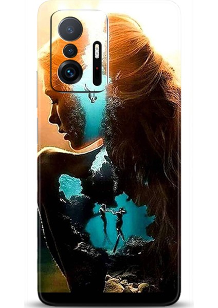 Xiaomi Mi 11T Kılıf Hd Baskılı Kılıf - Followed Institution 0377