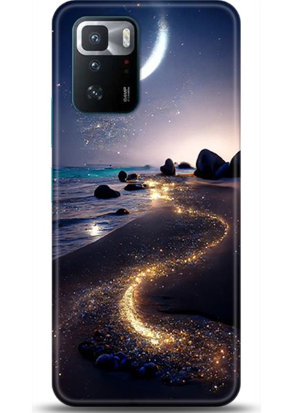 Xiaomi Poco X3 Gt Kılıf Hd Baskılı Kılıf - Followed Institution 0017