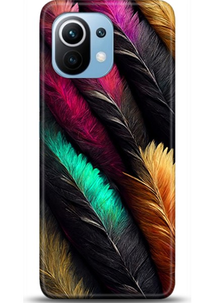 Xiaomi Mi 11 Kılıf Hd Baskılı Kılıf - Followed Institution 0671