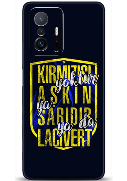 Xiaomi Mi 11T Kılıf Hd Baskılı Kılıf - Followed Institution 0551