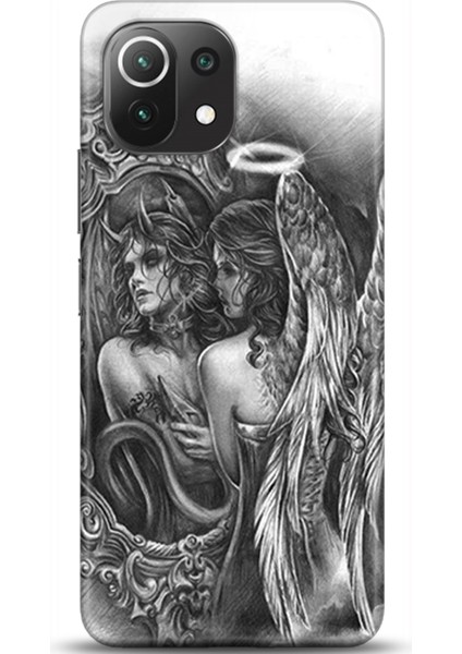 Xiaomi Mi 11 Lite Kılıf Hd Baskılı Kılıf - Followed Institution 0258