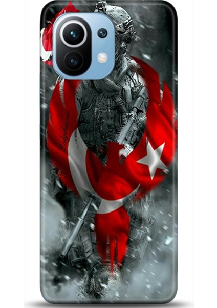 Xiaomi Mi 11 Kılıf Hd Baskılı Kılıf - Followed Institution 0231