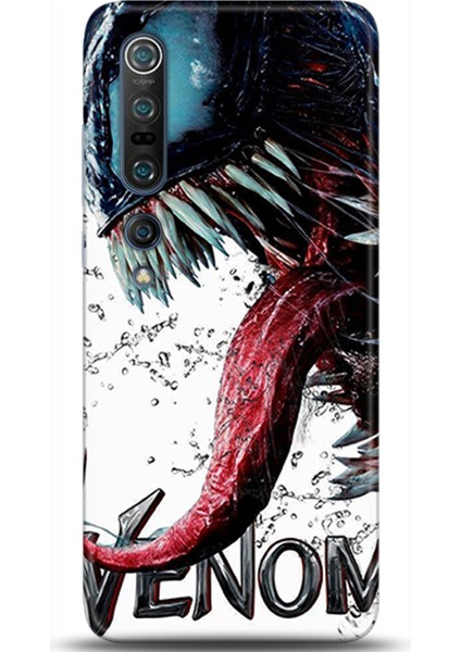 Xiaomi Mi 10 Pro Kılıf Hd Baskılı Kılıf - Followed Institution 0568